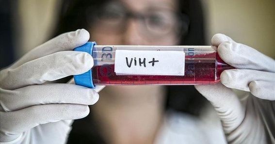 cientificos logran eliminar el vih con trasplantes de celulas madre 2